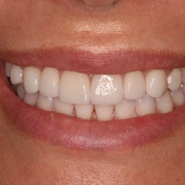 After Image