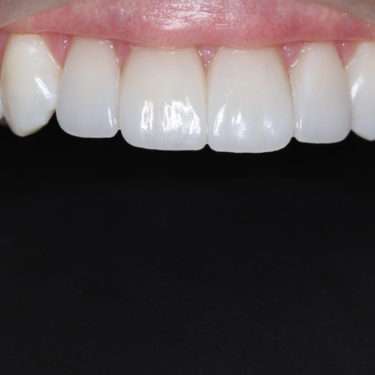 After Image