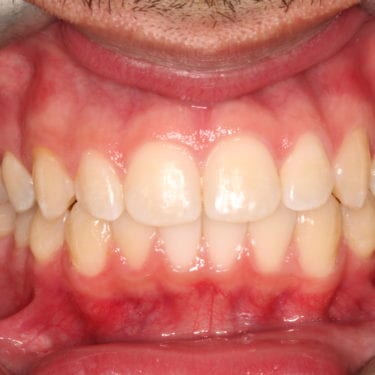 After Image
