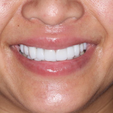 After Image
