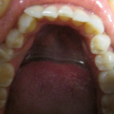 Before Image