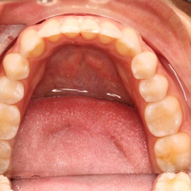 After Image